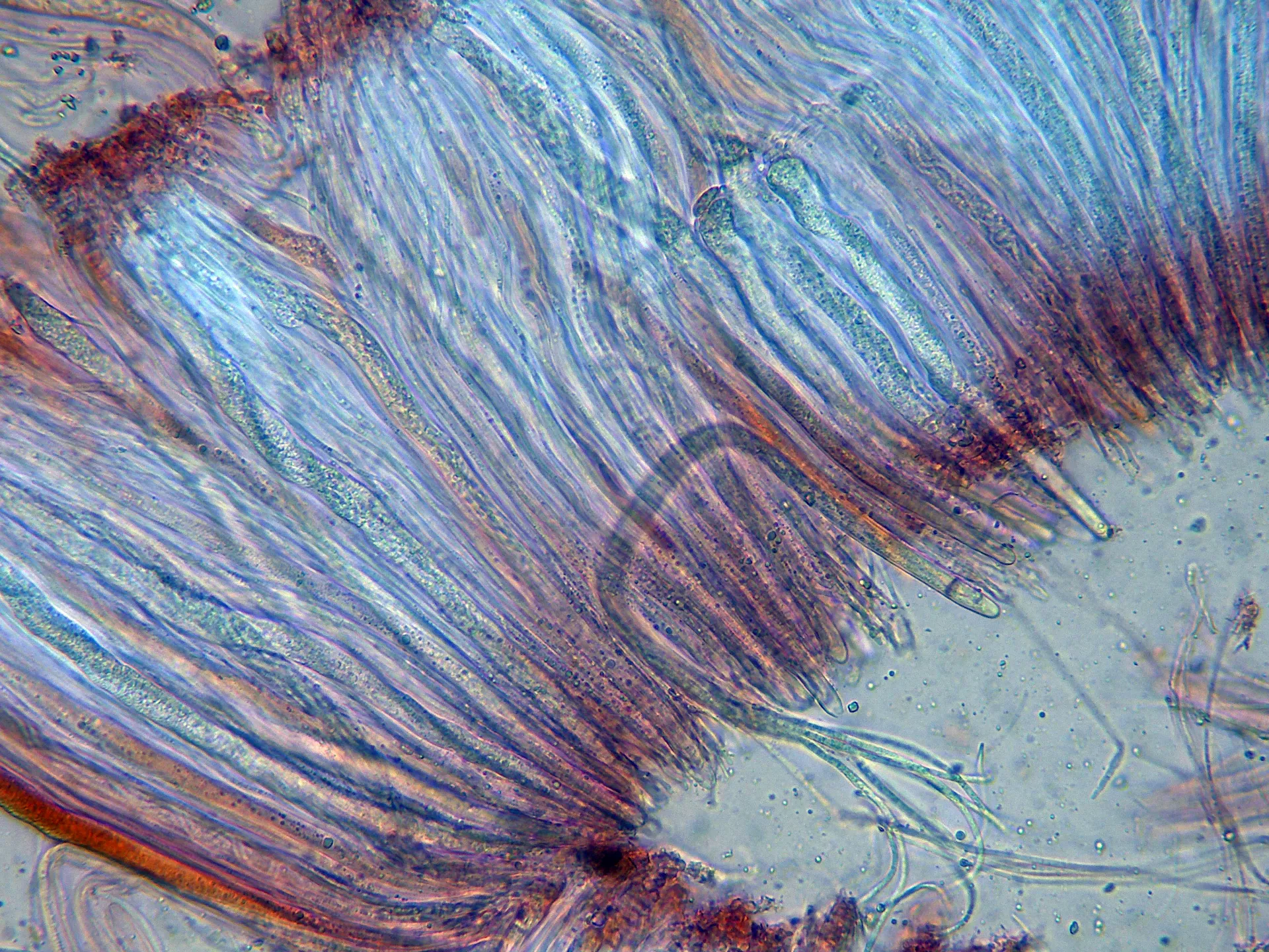 Microscopía de Stictis radiata - 10 - Himenio x 400-001